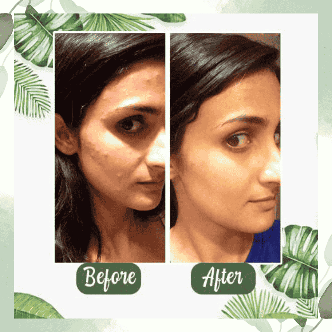 GREEN MAGIC STICK MASK: EL SECRETO PARA UNA PIEL RADIANCIENTE