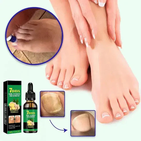 ACEITE ANTI-HONGOS VIVALIA™ – ADIÓS A LOS HONGOS DE UNA VEZ POR TODAS