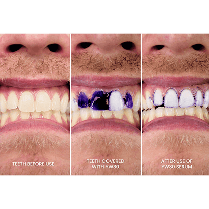 🚨 ¡TU SONRISA SE ESTÁ MANCHANDO! ELIMINA EL AMARILLO ANTES DE QUE SEA TARDE 🚨